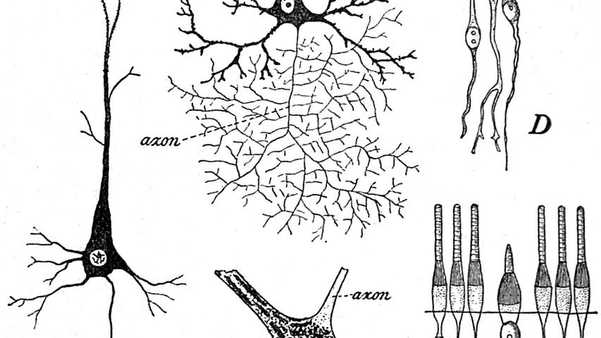 Classic histology drawing of a nerve cell — soma, dendrites and labelled axon